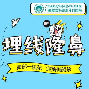 小ppo的更美日记